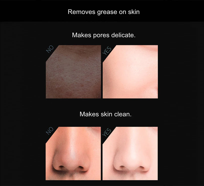 Skin comparison graphic for oil-absorbing face roller showing before and after panels